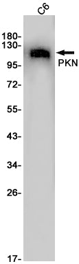 Anti-PKN1 Rabbit Monoclonal Antibody