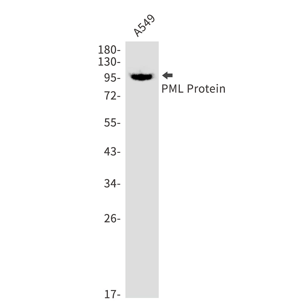 Anti-PML Protein Rabbit Monoclonal Antibody
