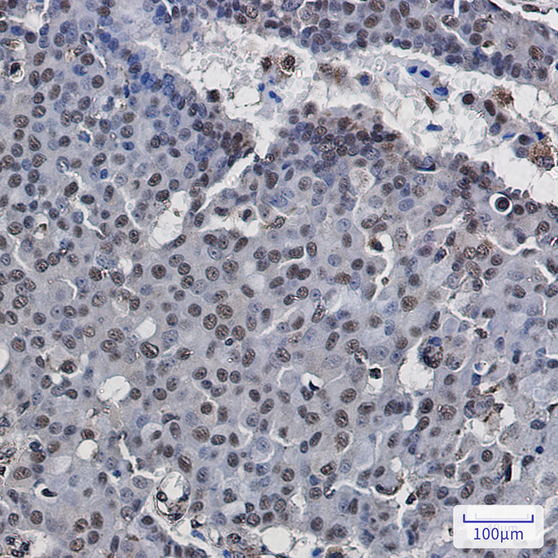 Anti-RNA Polymerases I/II/III Subunit ABC1 Rabbit Monoclonal Antibody