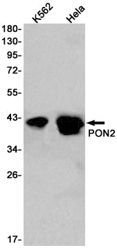 Anti-PON2 Rabbit Monoclonal Antibody