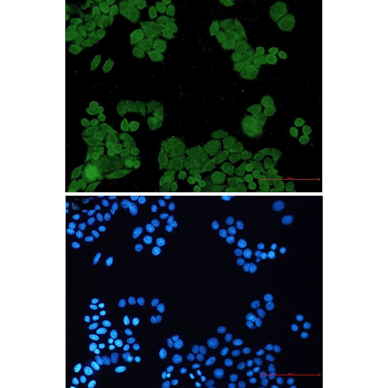 Anti-PP2A alpha/beta Rabbit Monoclonal Antibody