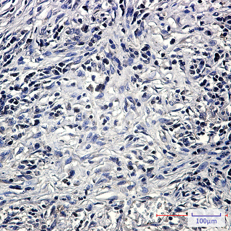Anti-PP2A alpha/beta Rabbit Monoclonal Antibody