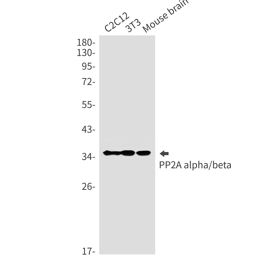Anti-PP2A alpha/beta Rabbit Monoclonal Antibody