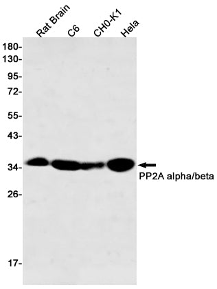 Anti-PP2A alpha/beta Rabbit Monoclonal Antibody