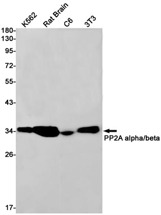 Anti-PP2A alpha/beta Rabbit Monoclonal Antibody