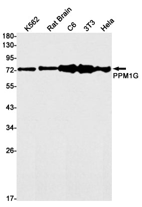 Anti-PPM1G Rabbit Monoclonal Antibody