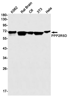 Anti-PPP2R5D Rabbit Monoclonal Antibody