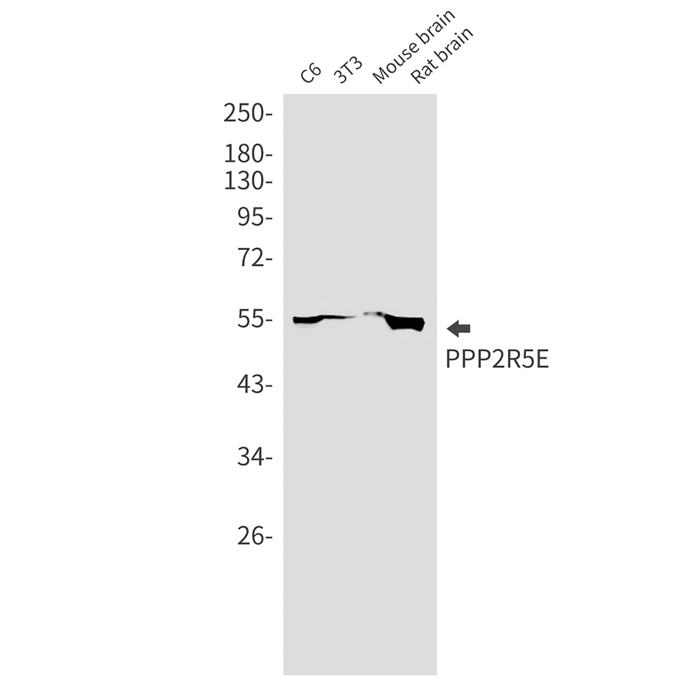 Anti-PPP2R5E Rabbit Monoclonal Antibody