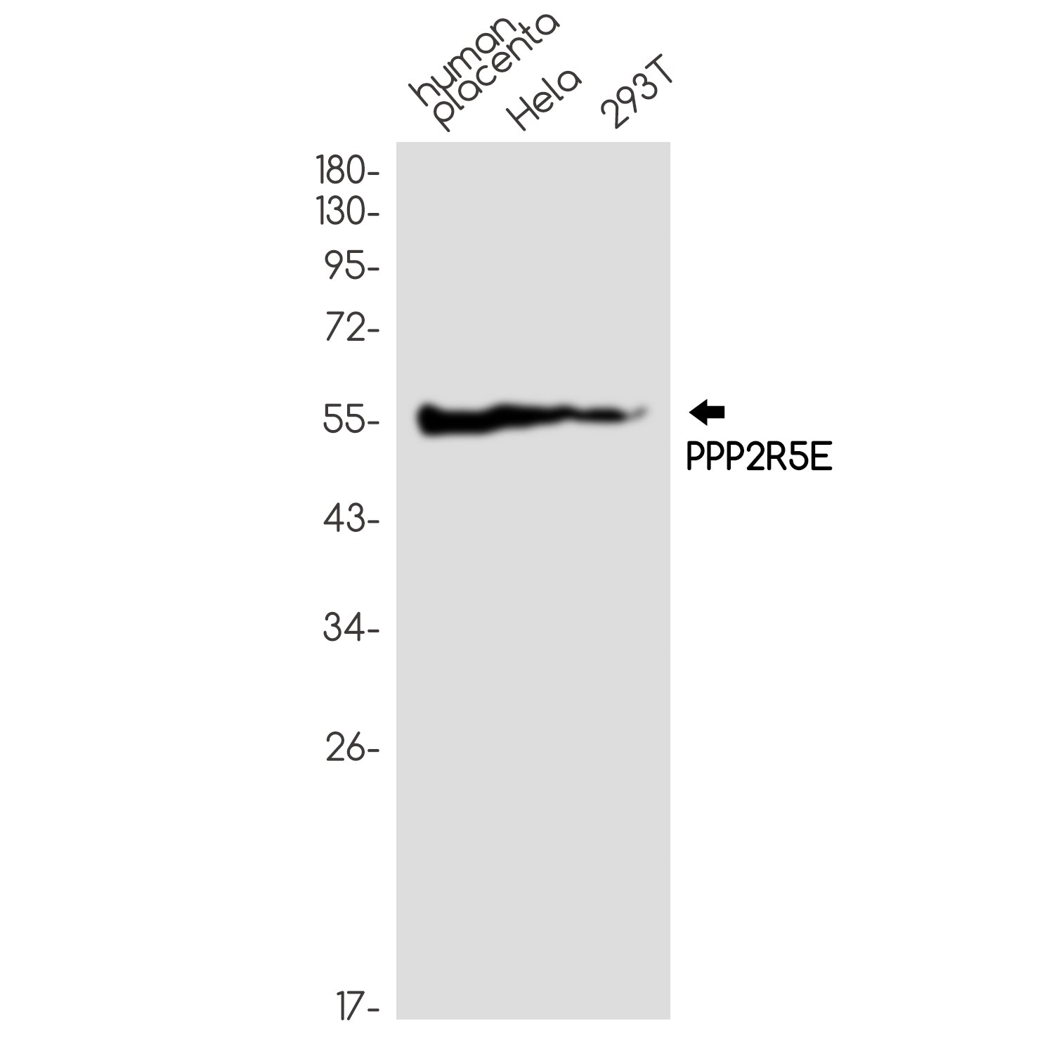 Anti-PPP2R5E Rabbit Monoclonal Antibody