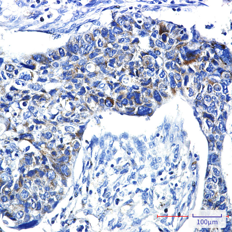 Anti-PRC1 Rabbit Monoclonal Antibody