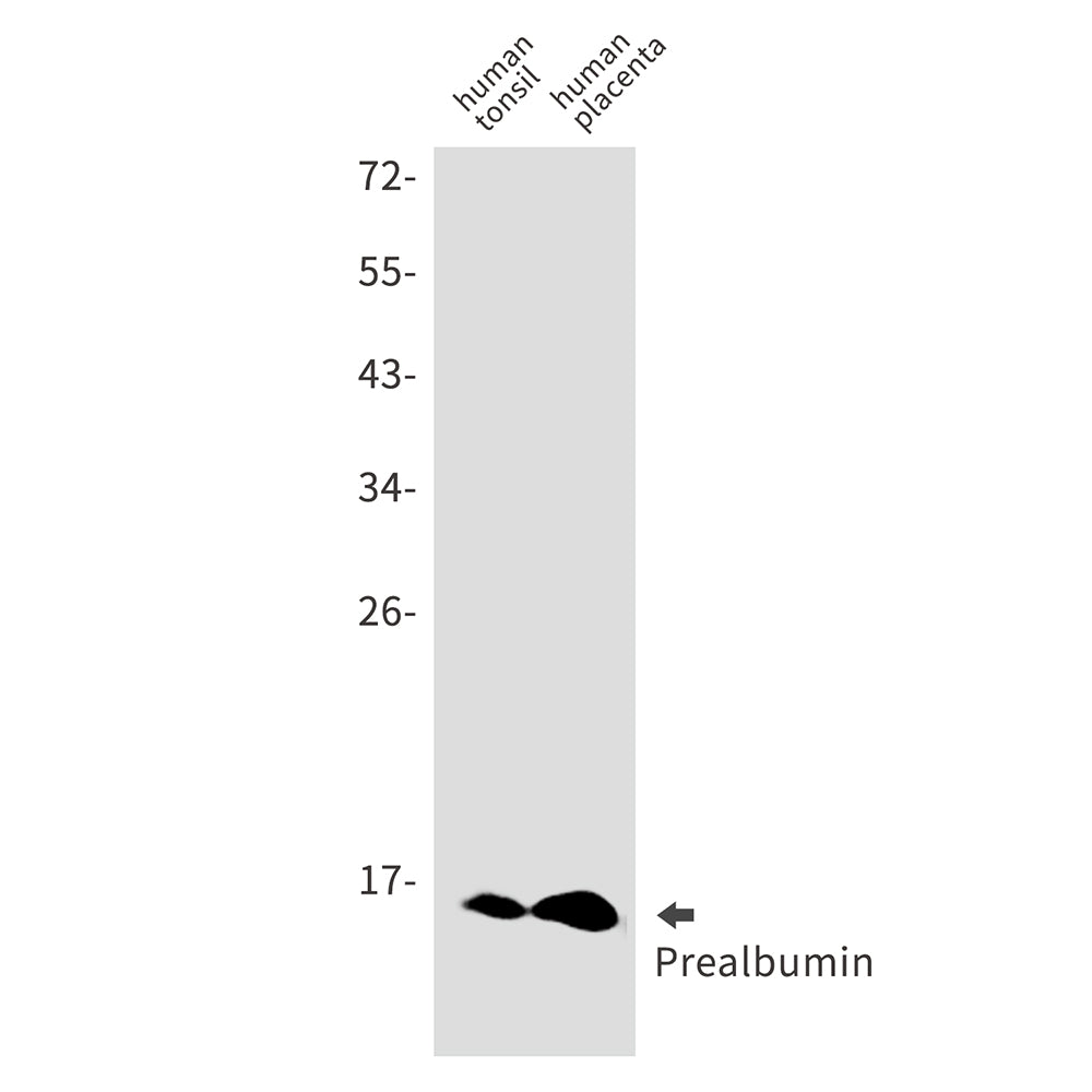 Anti-Prealbumin Rabbit Monoclonal Antibody