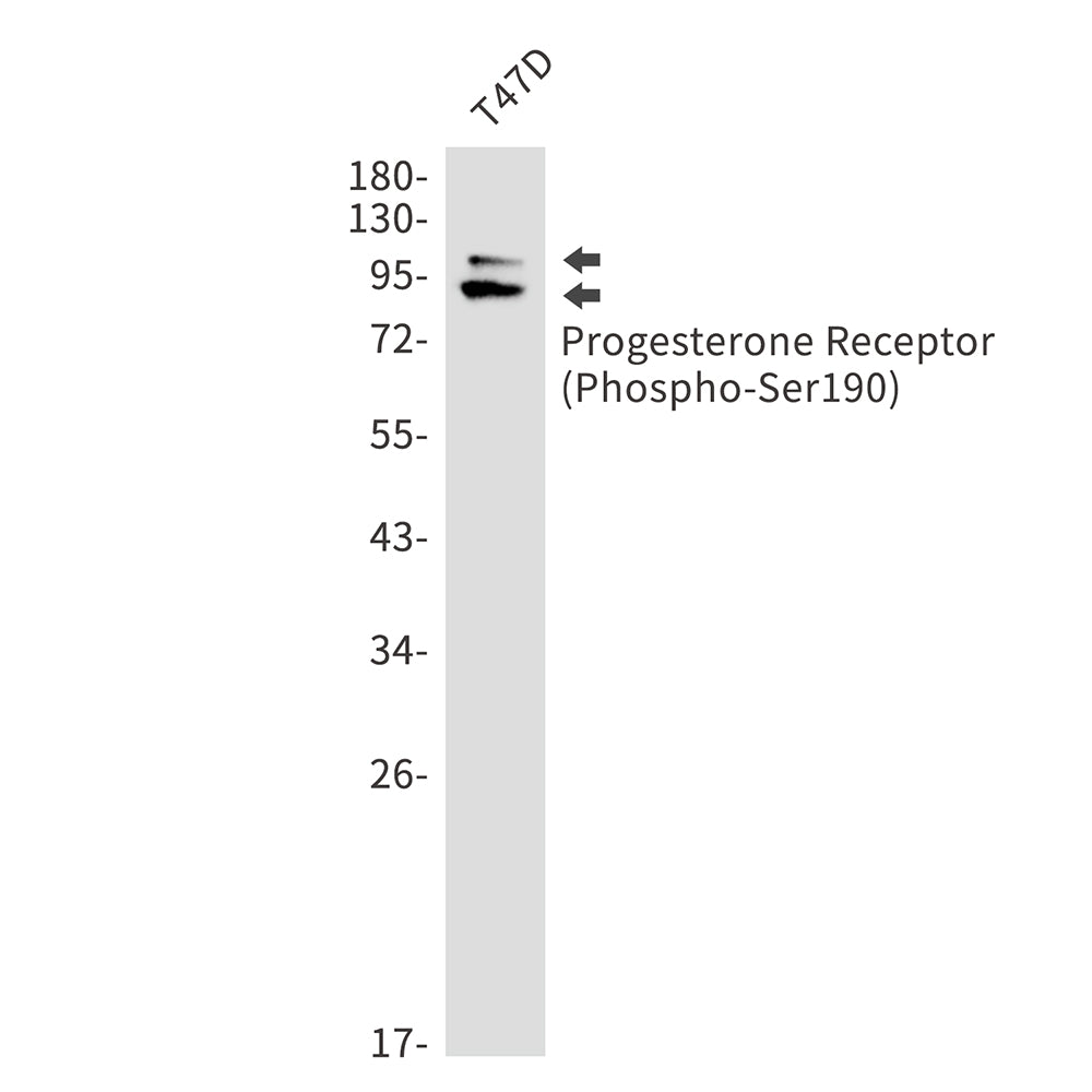 Anti-Phospho-Progesterone Receptor (Ser190) Rabbit Monoclonal Antibody
