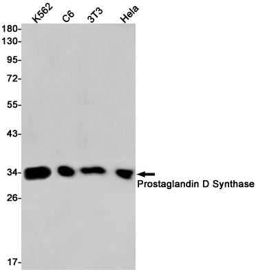 Anti-Prostaglandin D Synthase Rabbit Monoclonal Antibody