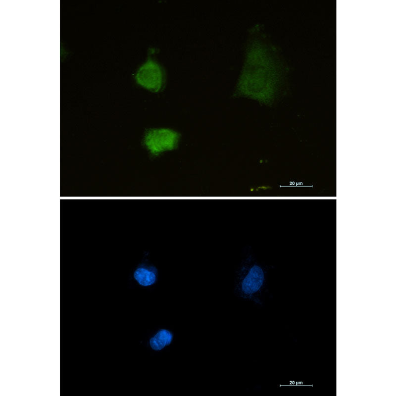 Anti-Proteasome alpha 2 Rabbit Monoclonal Antibody