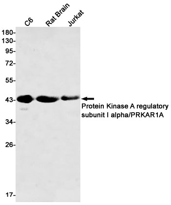Anti-PKA RI alpha Rabbit Monoclonal Antibody