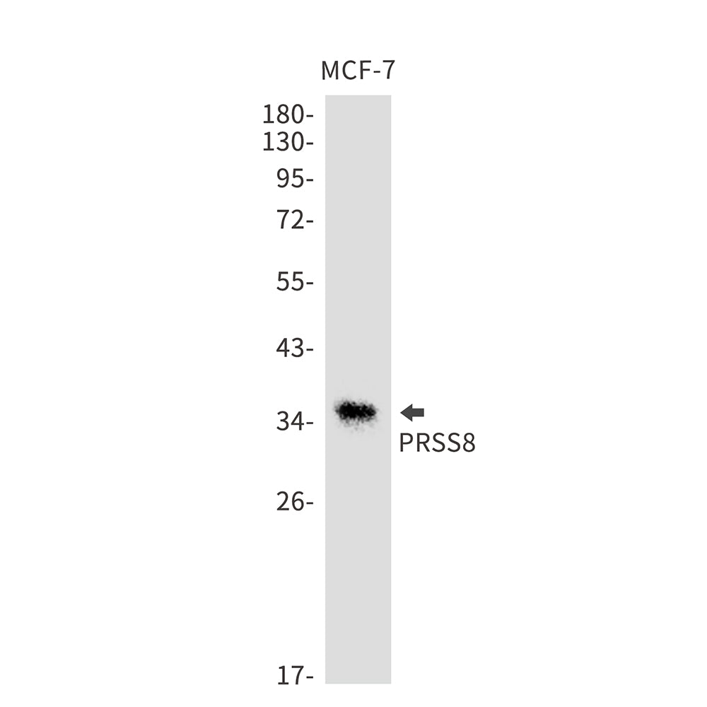 Anti-PRSS8 Rabbit Monoclonal Antibody