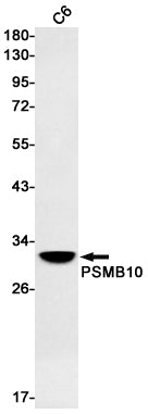 Anti-PSMB10 Rabbit Monoclonal Antibody