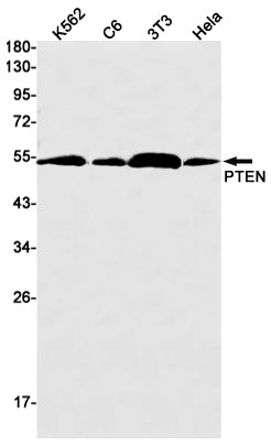 Anti-PTEN Rabbit Monoclonal Antibody