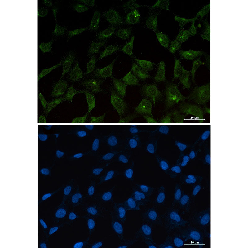 Anti-PUMA Rabbit Monoclonal Antibody