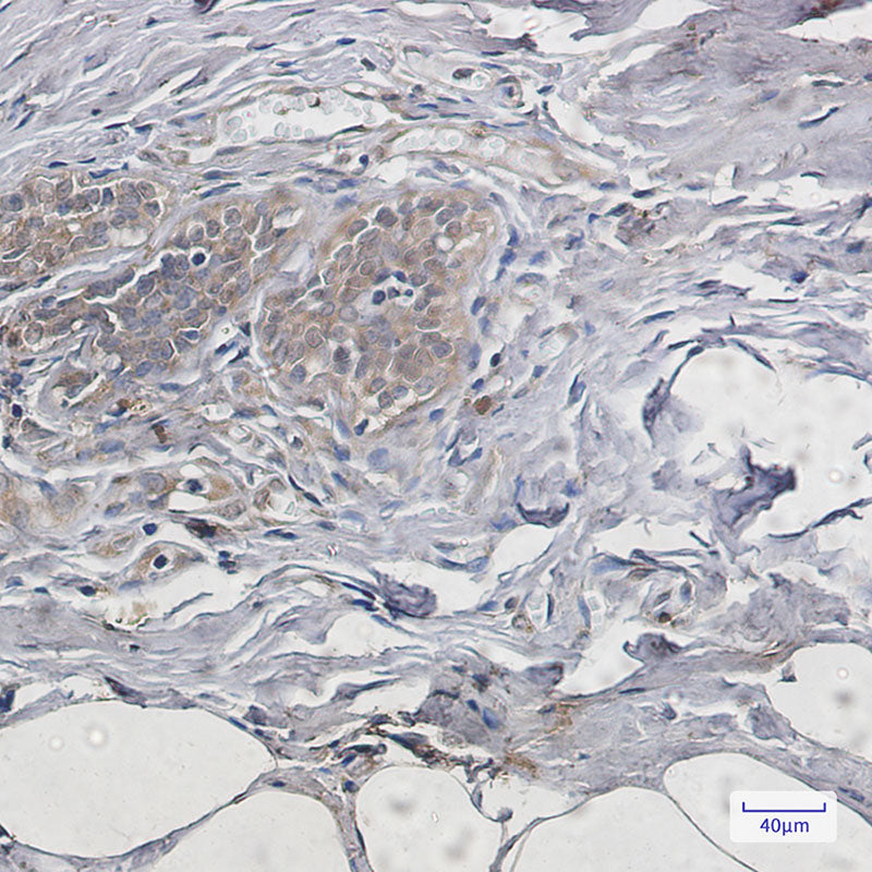 Anti-PUMA Rabbit Monoclonal Antibody