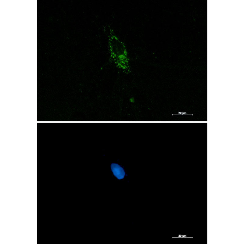 Anti-PUM1 Rabbit Monoclonal Antibody