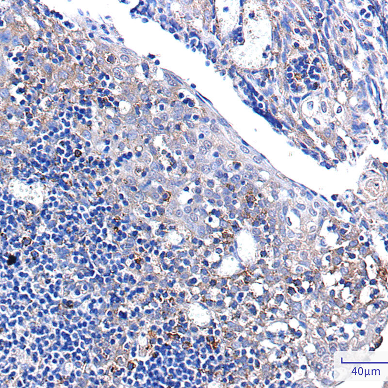 Anti-PUM1 Rabbit Monoclonal Antibody