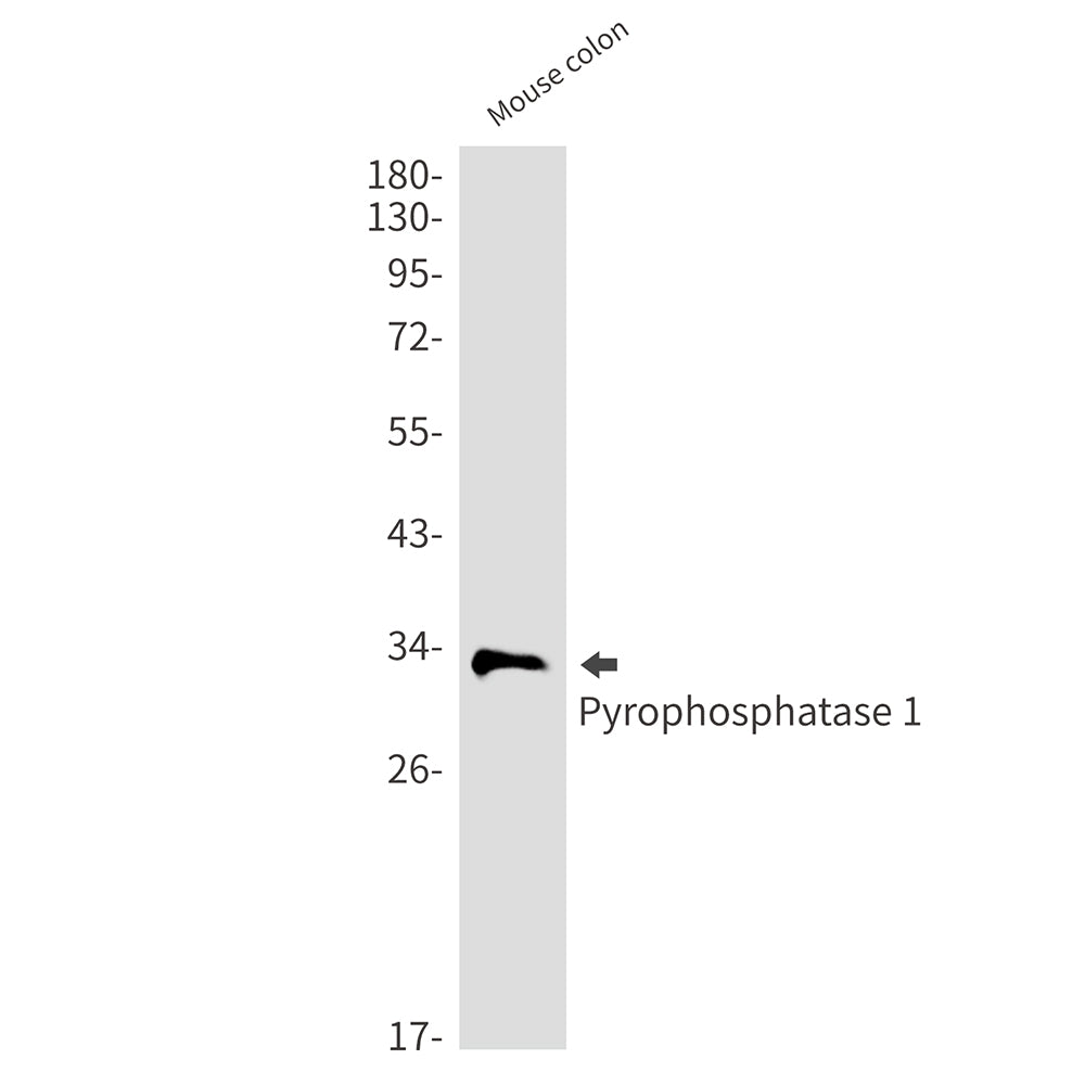 Anti-Pyrophosphatase 1 Rabbit Monoclonal Antibody