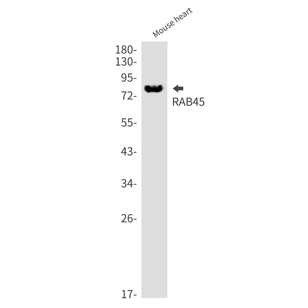 Anti-Rab45 Rabbit Monoclonal Antibody