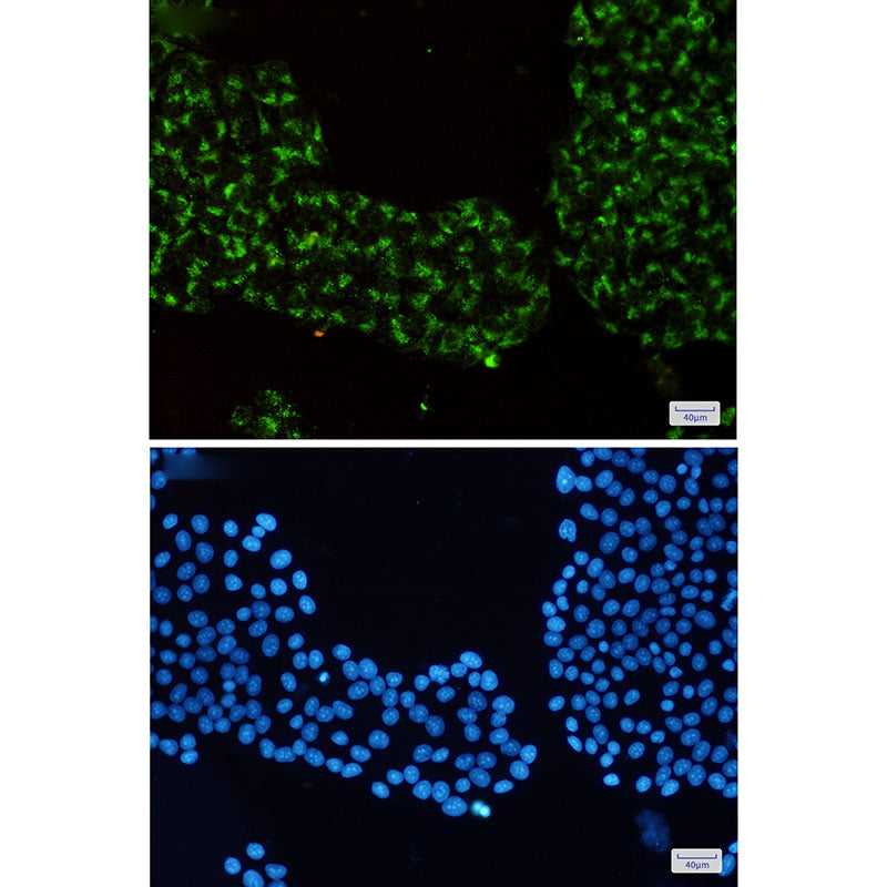 Anti-Rab7 Rabbit Monoclonal Antibody