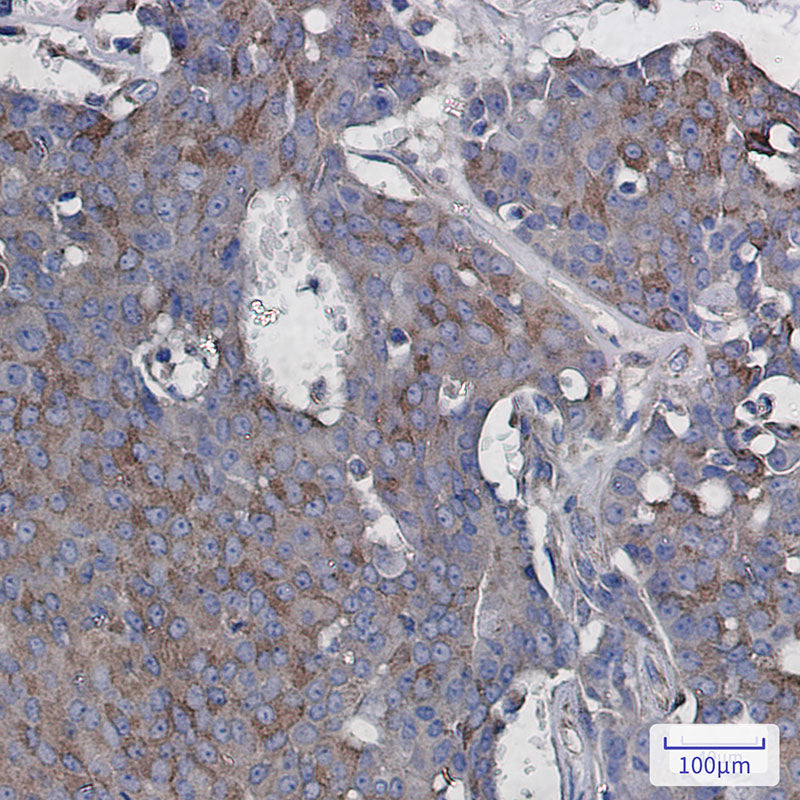 Anti-Rac3 Rabbit Monoclonal Antibody
