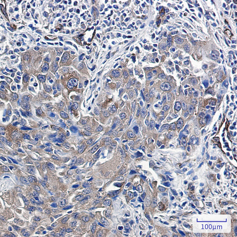 Anti-Radixin Rabbit Monoclonal Antibody