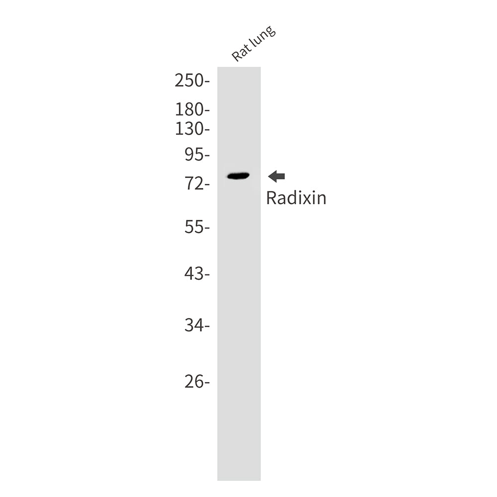 Anti-Radixin Rabbit Monoclonal Antibody
