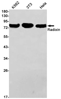 Anti-Radixin Rabbit Monoclonal Antibody