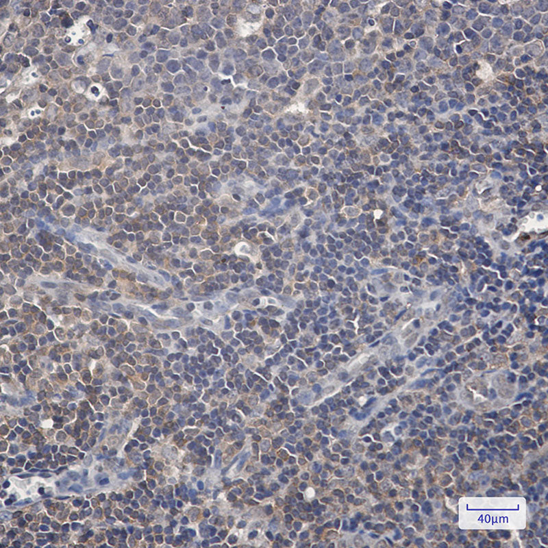 Anti-Phospho-Raf1 (Ser259) Rabbit Monoclonal Antibody