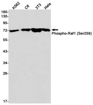 Anti-Phospho-Raf1 (Ser259) Rabbit Monoclonal Antibody
