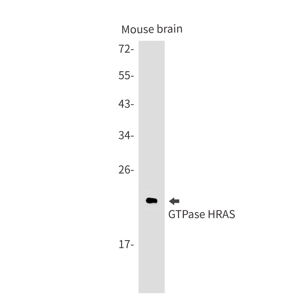Anti-GTPase HRAS Rabbit Monoclonal Antibody