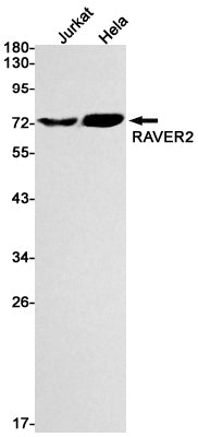 Anti-RAVER2 Rabbit Monoclonal Antibody