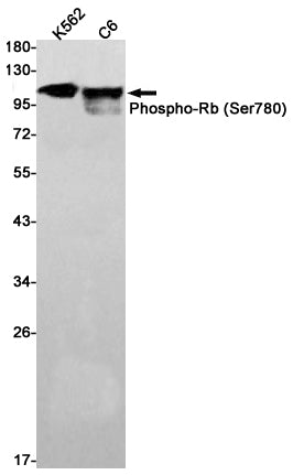 Anti-Phospho-Rb (Ser780) Rabbit Monoclonal Antibody