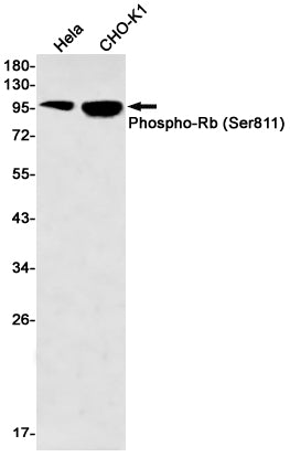 Anti-Phospho-Rb (Ser811) Rabbit Monoclonal Antibody