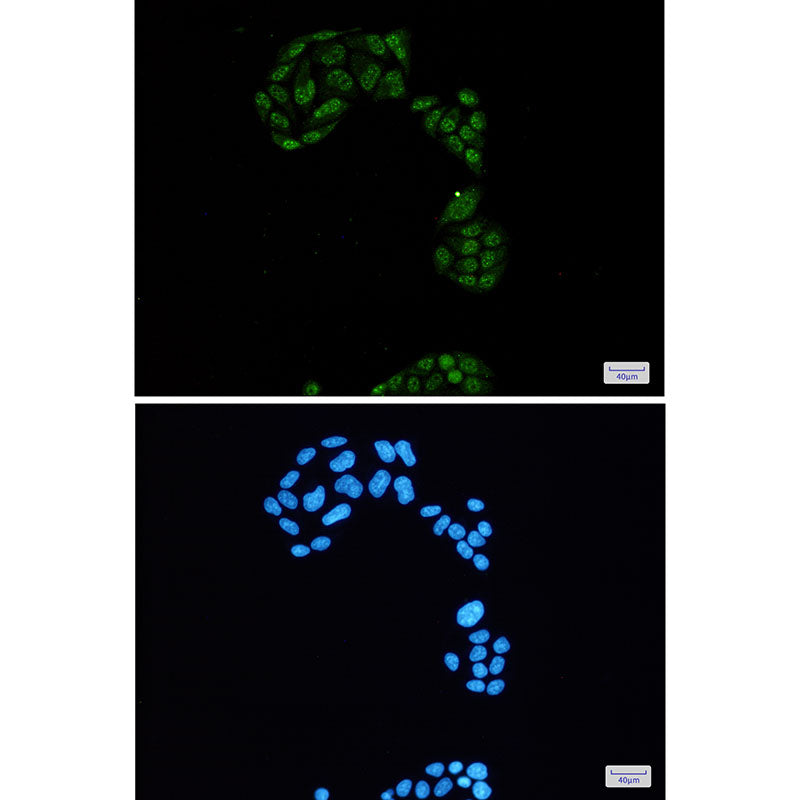 Anti-Phospho-Rb2 p130 (Ser952) Rabbit Monoclonal Antibody
