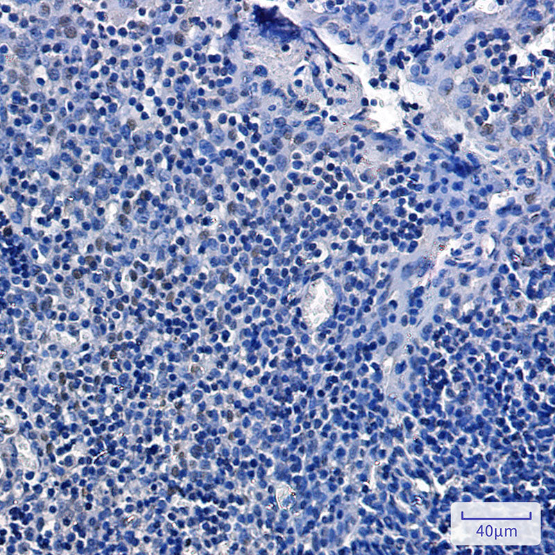 Anti-Phospho-Rb2 p130 (Ser952) Rabbit Monoclonal Antibody