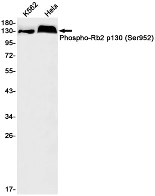 Anti-Phospho-Rb2 p130 (Ser952) Rabbit Monoclonal Antibody