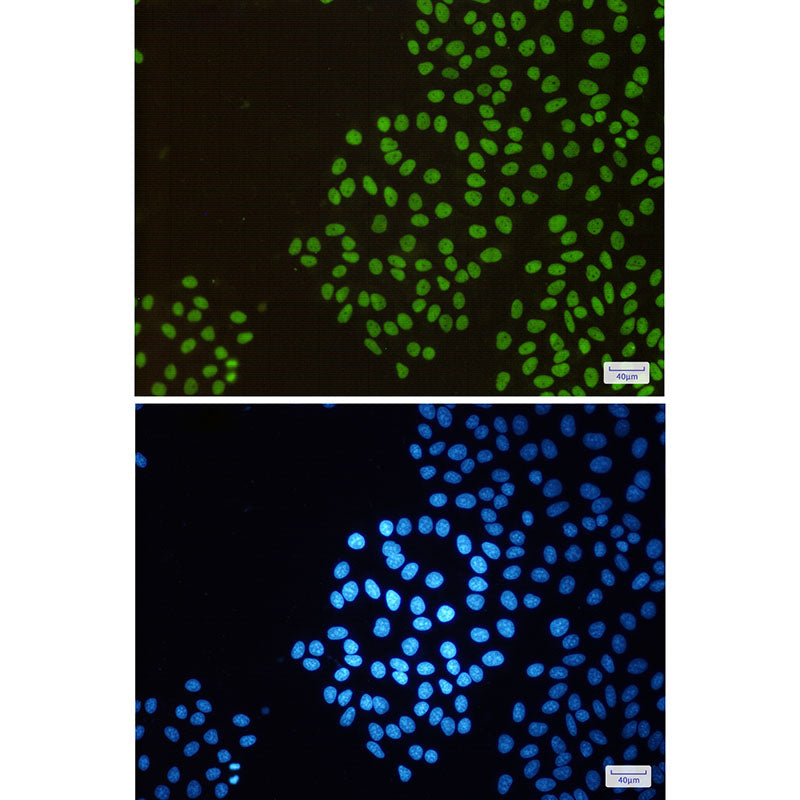 Anti-RBBP4 Rabbit Monoclonal Antibody