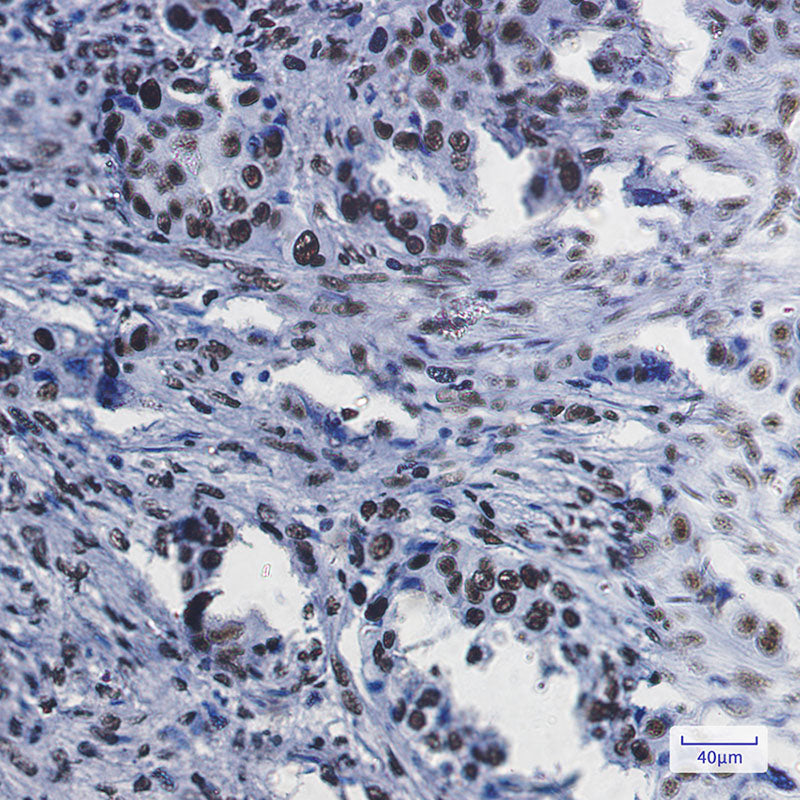 Anti-RBBP4 Rabbit Monoclonal Antibody