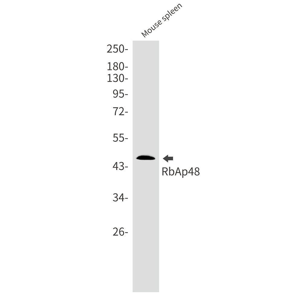 Anti-RBBP4 Rabbit Monoclonal Antibody