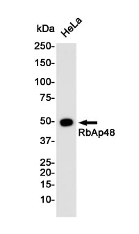 Anti-RBBP4 Rabbit Monoclonal Antibody