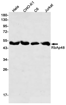 Anti-RBBP4 Rabbit Monoclonal Antibody