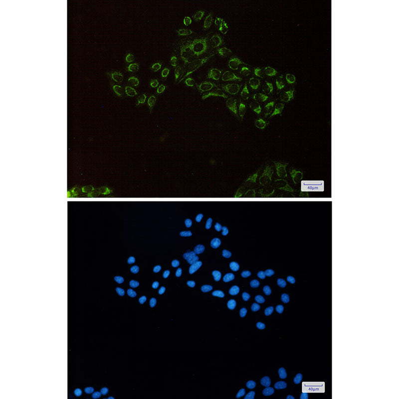 Anti-REA Rabbit Monoclonal Antibody