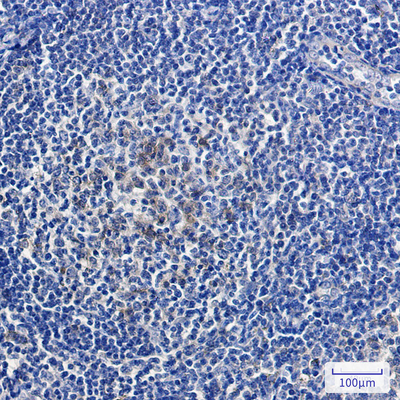 Anti-Relaxin 2 Rabbit Monoclonal Antibody