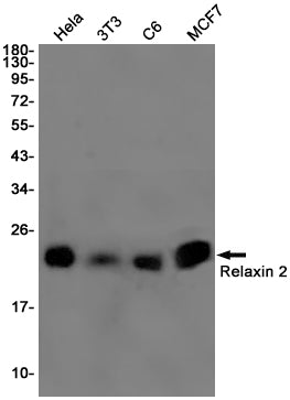 Anti-Relaxin 2 Rabbit Monoclonal Antibody